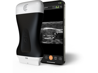 Product L15 High Freq Linear Handheld Portable Wireless Ultrasound Scanner