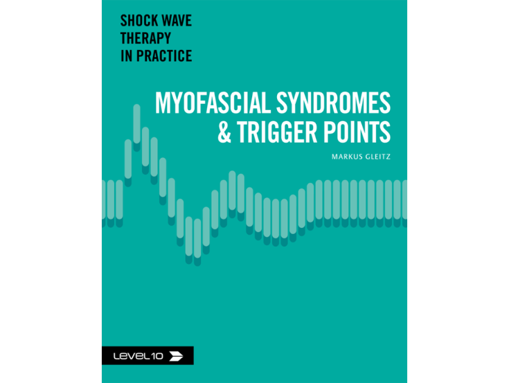 Shock wave therapy in practice. Myofascial syndromes and trigger points