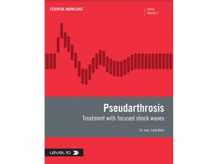 Pseudarthrosis treatment with focused shock waves